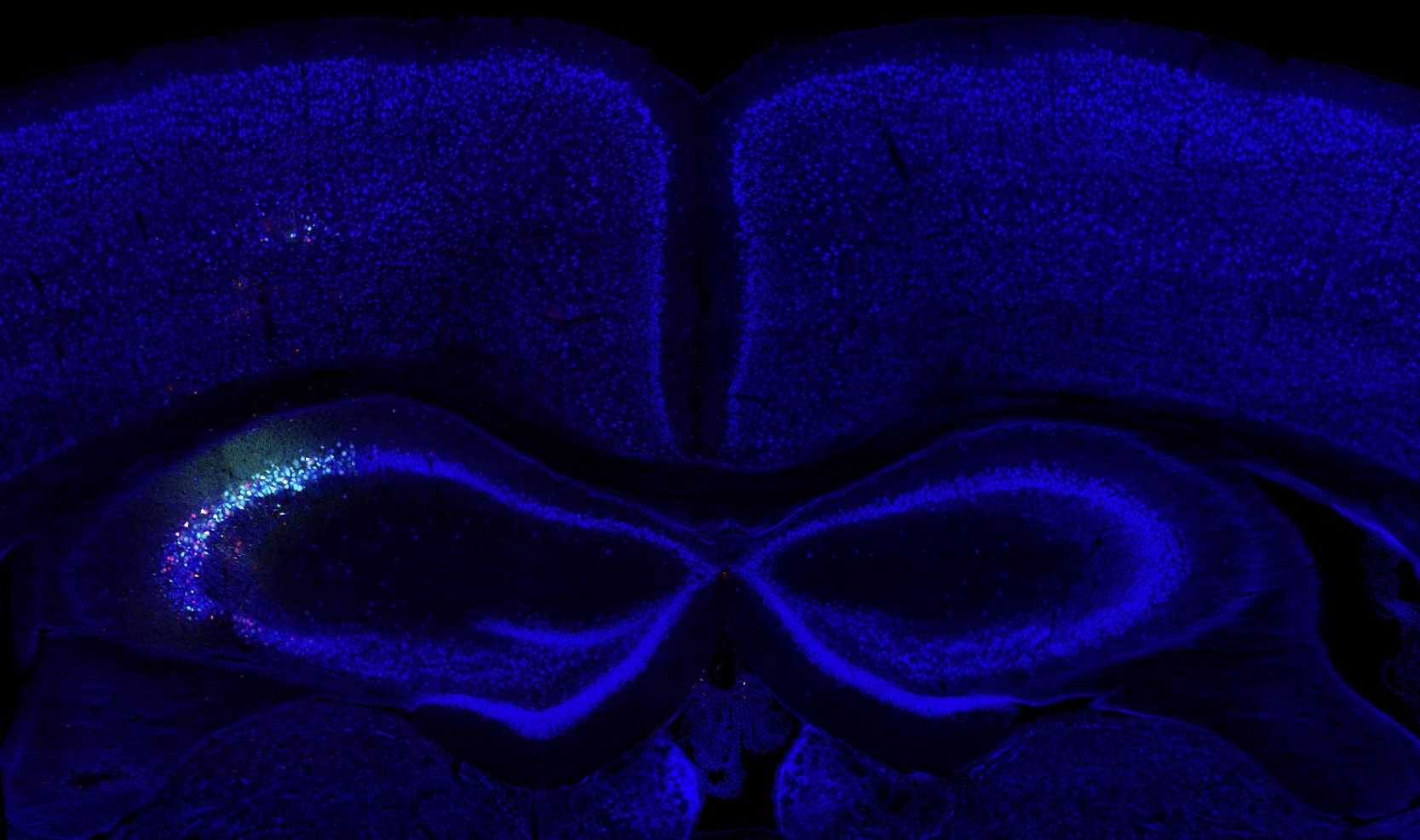 Engineering Viral Vectors for Acoustically Targeted Gene Delivery