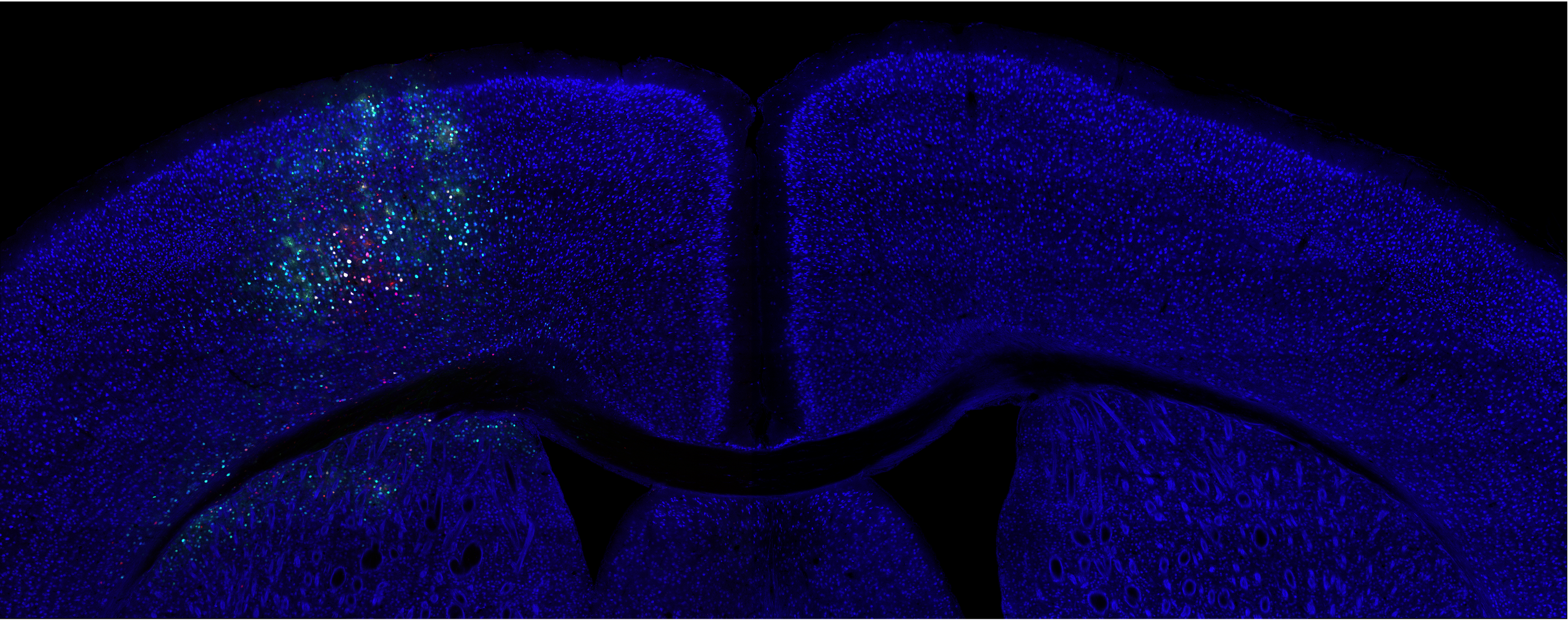 Engineering Viral Vectors for Acoustically Targeted Gene Delivery